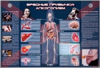 Электрифицированный стенд "Вредные привычки: алкоголизм" - fgospostavki.ru - Ногинск