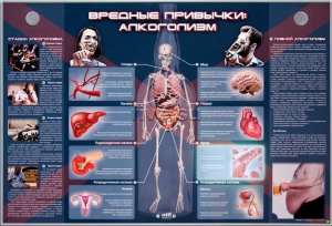 Электрифицированный стенд "Вредные привычки: алкоголизм" - fgospostavki.ru - Ногинск